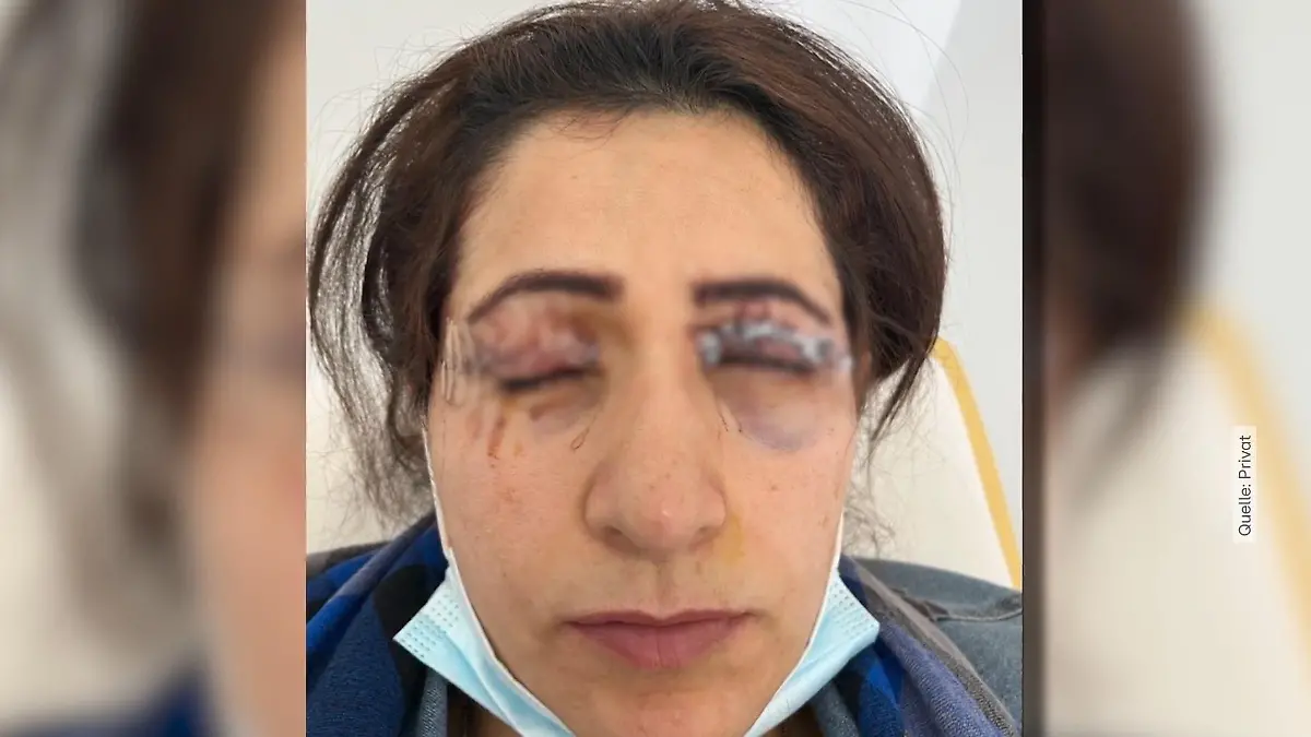 Nasrin can no longer close her eyes – serious allegations in court