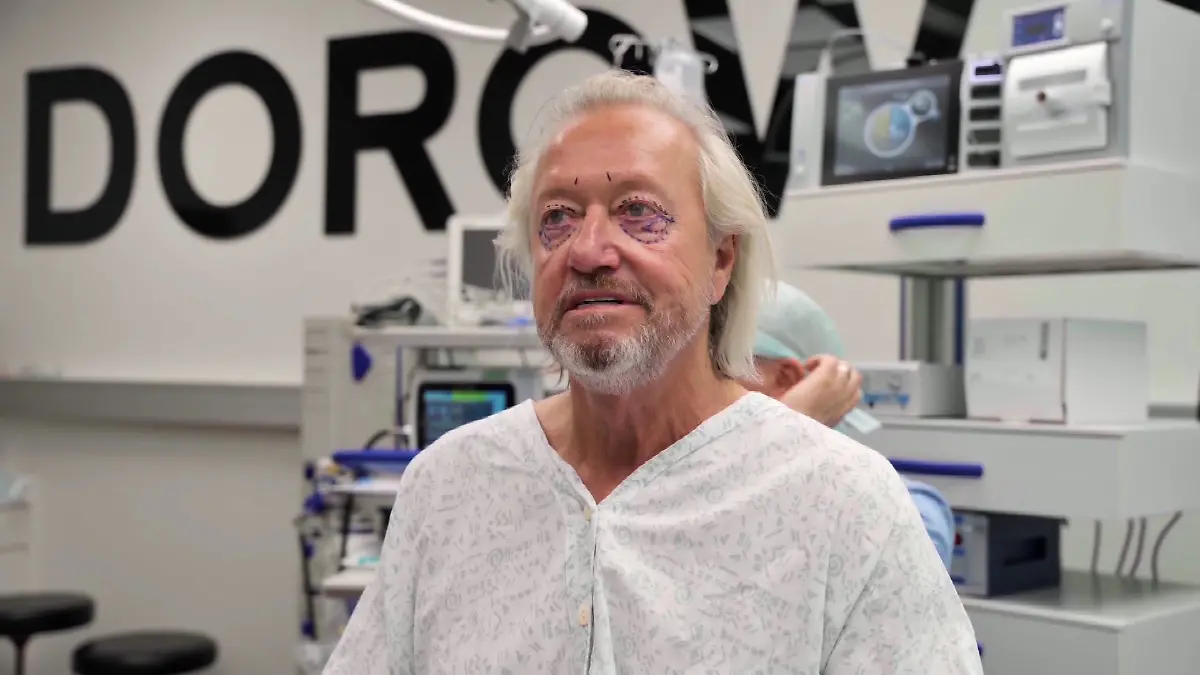 Robert Geiss' first cosmetic surgery – what does he look like now?