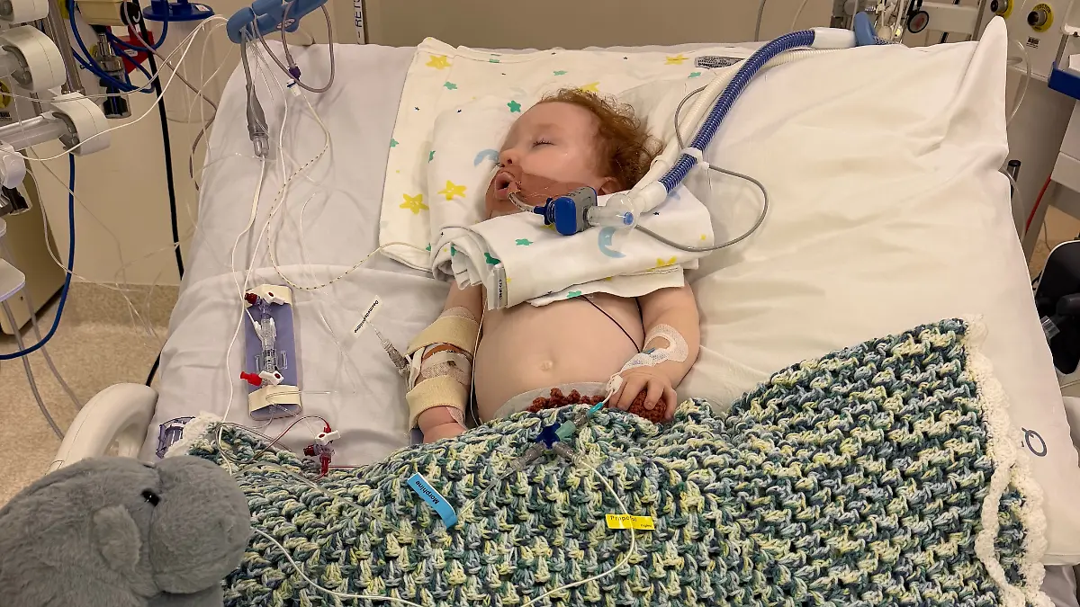14-month-old boy in coma after inhaling decorative powder while baking in Australia.