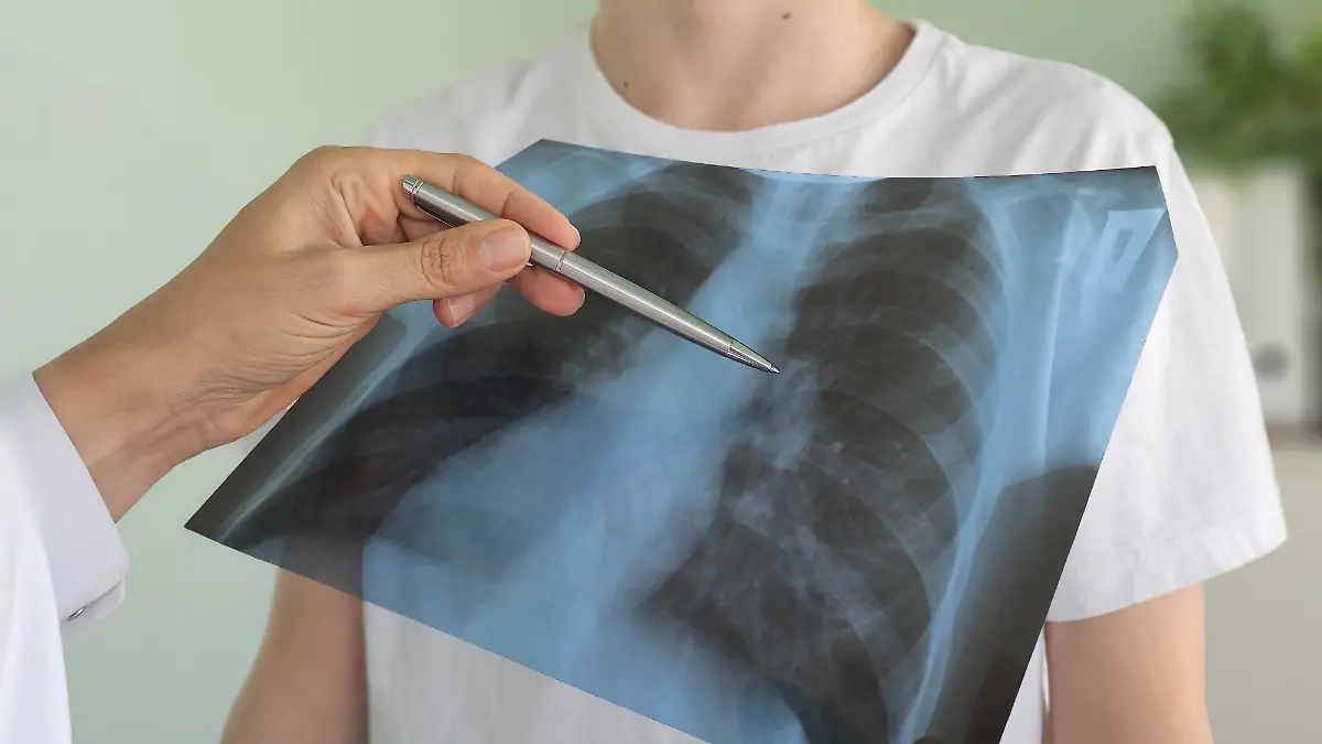 How does a lung transplant work? Mette-Marit from Norway is waiting for a new organ