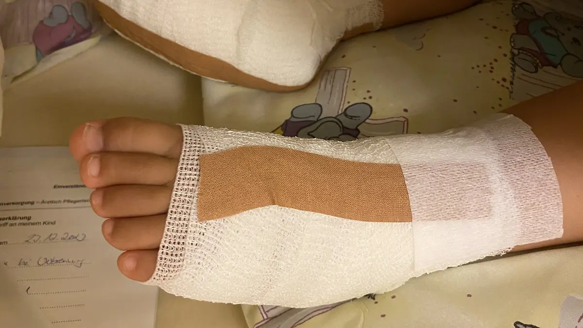 Two-year-old boy burns his feet